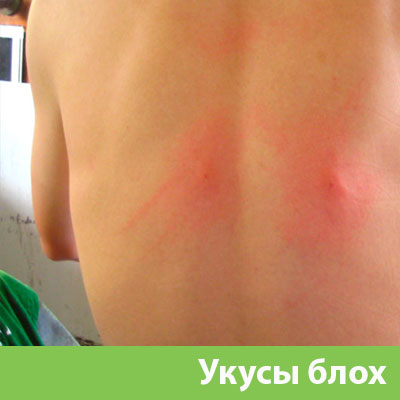 Укусы блох в Рубцовске