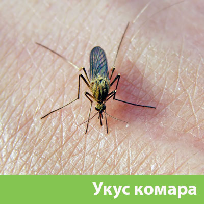 Укусы комаров в Рубцовске